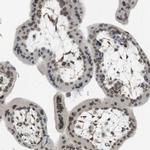 ARL6IP6 Antibody in Immunohistochemistry (IHC)