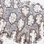 CYB561 Antibody in Immunohistochemistry (Paraffin) (IHC (P))