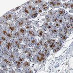 CYB561 Polyclonal Antibody