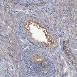 CYB561 Antibody in Immunohistochemistry (Paraffin) (IHC (P))
