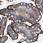 CYBRD1 Polyclonal Antibody