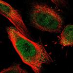 DSE Polyclonal Antibody