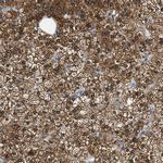 ALDH3A2 Polyclonal Antibody