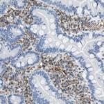 MS4A10 Antibody in Immunohistochemistry (Paraffin) (IHC (P))