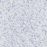 MS4A10 Antibody in Immunohistochemistry (Paraffin) (IHC (P))