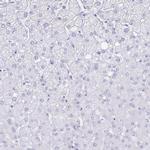 Aquaporin 4 Antibody in Immunohistochemistry (IHC)