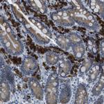 CLPTM1L Antibody in Immunohistochemistry (Paraffin) (IHC (P))