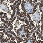CLPTM1L Antibody in Immunohistochemistry (Paraffin) (IHC (P))