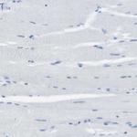 CLPTM1L Antibody in Immunohistochemistry (Paraffin) (IHC (P))