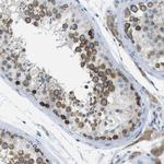 CLPTM1L Antibody in Immunohistochemistry (Paraffin) (IHC (P))