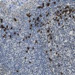 CLPTM1L Antibody in Immunohistochemistry (Paraffin) (IHC (P))