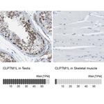 CLPTM1L Antibody