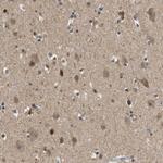 STCH Antibody in Immunohistochemistry (Paraffin) (IHC (P))