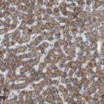 STCH Antibody in Immunohistochemistry (Paraffin) (IHC (P))