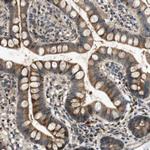 STCH Antibody in Immunohistochemistry (Paraffin) (IHC (P))