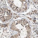 STCH Polyclonal Antibody