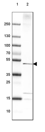 PTPLAD1 Antibody in Western Blot (WB)