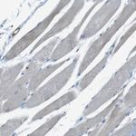 YIF1A Antibody in Immunohistochemistry (Paraffin) (IHC (P))