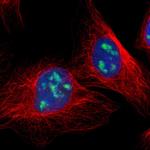 DDX47 Polyclonal Antibody