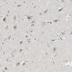 DDX47 Antibody in Immunohistochemistry (Paraffin) (IHC (P))