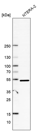 DDX47 Antibody in Western Blot (WB)