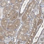 BCAR3 Antibody in Immunohistochemistry (Paraffin) (IHC (P))