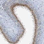 YIPF3 Antibody in Immunohistochemistry (IHC)