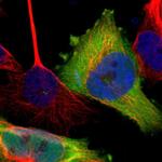 TSG Polyclonal Antibody