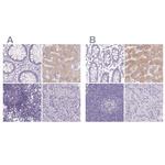 ASGR2 Antibody in Immunohistochemistry (IHC)