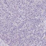ASGR2 Antibody in Immunohistochemistry (IHC)