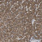 SSR3 Antibody in Immunohistochemistry (Paraffin) (IHC (P))