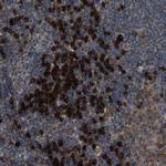 SSR3 Antibody in Immunohistochemistry (Paraffin) (IHC (P))