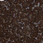 SSR3 Antibody in Immunohistochemistry (Paraffin) (IHC (P))