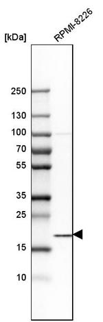 SSR3 Antibody in Western Blot (WB)