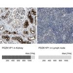 MAP17 Antibody in Immunohistochemistry (IHC)
