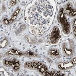 MAP17 Antibody in Immunohistochemistry (IHC)