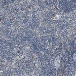 MAP17 Antibody in Immunohistochemistry (IHC)