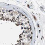 ZFPL1 Antibody in Immunohistochemistry (Paraffin) (IHC (P))