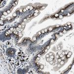 ZFPL1 Antibody in Immunohistochemistry (IHC)