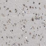 ZFPL1 Antibody in Immunohistochemistry (IHC)