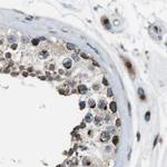 ZFPL1 Antibody in Immunohistochemistry (IHC)