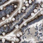 ZFPL1 Antibody in Immunohistochemistry (IHC)