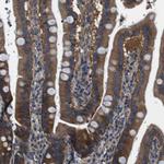 DENND4C Antibody in Immunohistochemistry (IHC)