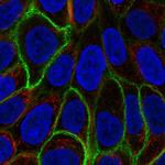 Aquaporin 3 Polyclonal Antibody