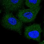 TRIM47 Polyclonal Antibody