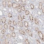 TRIM47 Antibody in Immunohistochemistry (Paraffin) (IHC (P))