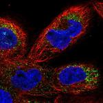 TMEM41B Polyclonal Antibody