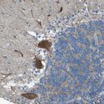 TMEM41B Antibody in Immunohistochemistry (Paraffin) (IHC (P))