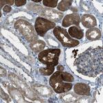 TMEM41B Antibody in Immunohistochemistry (Paraffin) (IHC (P))