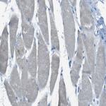 TMEM41B Antibody in Immunohistochemistry (Paraffin) (IHC (P))